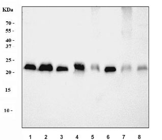 Western blot testing of 1) rat liver, 2) rat brain, 3) rat small intestine, 4) rat RH35, 5) mouse liver, 6) mouse brain, 7) mouse small intestine and 8) mouse Neuro-2a cell lysate with COX2 antibody. Predicted molecular weight ~25 kDa.