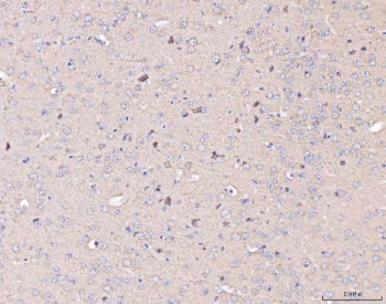 IHC staining of FFPE mouse brain tissue with COX2 antibody. HIER: boil tissue sections in pH8 EDTA for 20 min and allow to cool before testing.