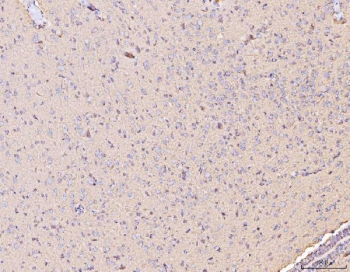 IHC staining of FFPE rat brain tissue with COX2 antibody. HIER: boil tissue sections in pH8 EDTA for 20 min and allow to cool before testing.
