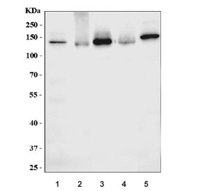 Western blot testing of 1) human placenta, 2) human U-87 MG, 3) human PC-3, 4) human MCF7 and 5) rat stomach lysate with NRP1 antibody. Expected molecular weight: 102-130 kDa.