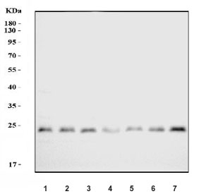 Western blot testing of 1) rat brain, 2) rat liver, 3) rat kidney, 4) rat pancreas, 5) mouse brain, 6) mouse liver and 7) mouse kidney tissue cell lysate with Proteasome 20S beta 7 antibody. Predicted molecular weight ~30 kDa.