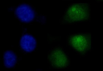 Immunofluorescent staining of FFPE human A549 cells with PTP1C antibody (green) and DAPI nuclear stain (blue). HIER: steam section in pH6 citrate buffer for 20 min.