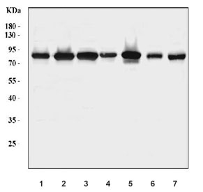 Western blot testing of 1) human 293T, 2) human HepG2, 3) human LNCaP, 4) rat brain, 5