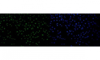 Immunofluorescent staining of FFPE human HeLa cells with p53 binding protein 1 antibody (green) and DAPI nuclear stain (blue). HIER: steam section in pH6 citrate buffer for 20 min.