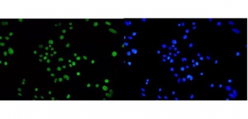 Immunofluorescent staining of FFPE human SiHa cells with TPR antibody (green) and DAPI nuclear stain (blue). HIER: steam section in pH6 citrate buffer for 20 min.