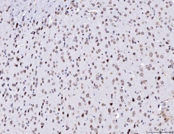 IHC staining of FFPE mouse brain tissue with TPR antibody. HIER: boil tissue sections in pH8 EDTA for 20 min and allow to cool before testing.