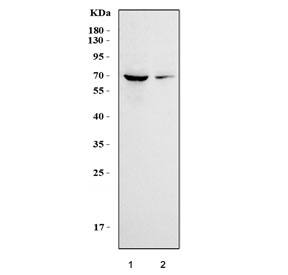 Western blot testing of human 1) Jurkat and 2) HUT-78 cell lysate with CD28 ant