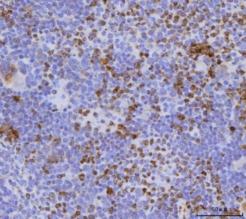 IHC staining of FFPE mouse spleen tissue with Cdc25b antibody. HIER: boil tissue sections in pH8 EDTA for 20 min and allow to cool before testing.~