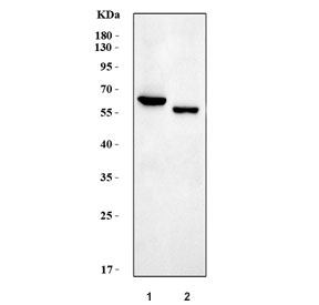 Western blot testing of 1) rat liver and 2) mouse liver tissue lysate with Cdc25b antibody. Expected