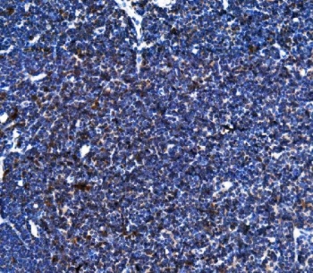 IHC staining of FFPE rat lymph node tissue with Blr1 antibody. HIER: boil tissue sections in pH8 EDTA for 20 min and allow to cool before testing.~