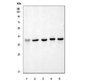 Western blot testing of human 1) MCF7, 2) HepG2, 3) HeLa, 4) U-87 MG and 5) A