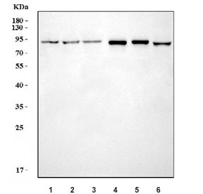 Western blot testing of 1) human HeLa, 2) human 293T, 3) human A549, 4) rat kidney, 5) mouse kidney and 6) mouse NIH 3T3 cell lysate with Fes/Fps antibody. Predicted molecular weight ~93 kDa.