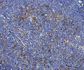 IHC staining of FFPE rat thymus tissue with Il2r alpha antibody. HIER: boil tissue sections in pH8 EDTA for 20 min and allow to cool before testing.