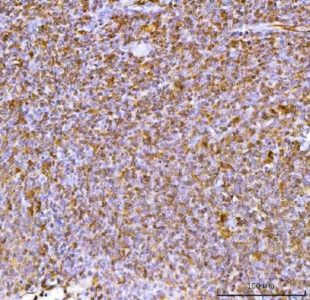 IHC staining of FFPE human tonsil tissue with Interleukin 34 antibody. HIER: boil tissue sections in pH8 EDTA for 20 min and allow to cool before testing.~