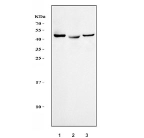 Western blot testing of human 1) HepG2, 2) A549 and 3) SH-SY5Y cell lysate with Interleukin 3