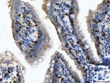 IHC staining of FFPE mouse colon tissue with Itgae antibody. HIER: boil tissue sections in pH8 EDTA for 2