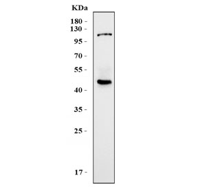 Western blot testing of human placental tissue lysate with KCa3.1 antibody. Predicted molecular weight ~48 kDa.