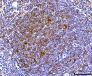 IHC staining of FFPE mouse spleen tissue with NCR1 antibody. HIER: boil tissue sections in pH8 EDTA for 20 min and allow to cool before testing.~