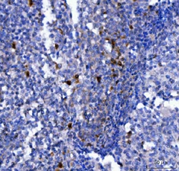 IHC staining of FFPE human tonsil tissue with NCR1 antibody. HIER: boil tissue sections in pH8 EDTA for