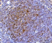 IHC staining of FFPE mouse spleen tissue with NCR1 antibody. HIER: boil tissue sections in pH8 EDTA for 20 min and allow to cool before testing.