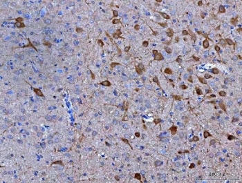 IHC staining of FFPE rat brain tissue with Neuromedin-S antibody. HIER: boil tissue sections in pH8 EDTA for 20 min and allow to cool before testing.~