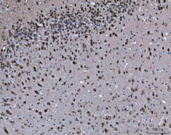 IHC staining of FFPE mouse brain tissue with Protein arginine N-methyltransferase 5 antibody. HIER: boil tissue sections in pH8 EDTA for 20 min and allow to cool before testing.