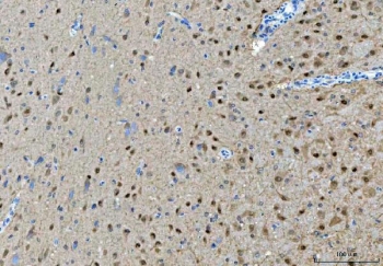 IHC staining of FFPE rat brain tissue with Protein arginine N-methyltransferase 5 antibody. HIER: boil tissue sections in pH8 EDTA for 20 min and allow to cool before testing.