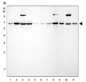 Western blot testing of 1) human HepG2, 2) human Jurkat, 3) human Raji, 4) human 293, 5) human HL60, 6) human PC-3, 7) human A431, 8) human Daudi, 9) rat brain, 10) rat C6 and 11) mouse brain tissue lysate with Protein arginine N-methyltransferase 5 antibody. Expected molecular weight ~72 kDa.