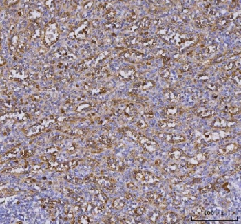 IHC staining of FFPE human spleen tissue with TLR9 antibody. HIER: boil tissue sections in pH8 EDTA for 20 min and allow to cool before testing.~