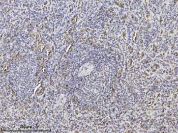 IHC staining of FFPE human spleen tissue with SLC4A1 antibody. HIER: boil tissue sections in pH8 EDTA for 20 min and allow to cool before testing.