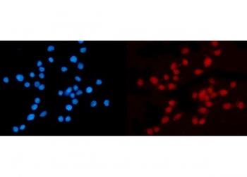 Immunofluorescent staining of FFPE human Caco-2 cells with KPNB1 antibody (red) and DAPI nuclear stain (blue). HIER: steam section in pH6 citrate buffer for 20 min.