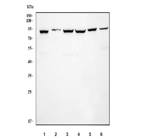 Western blot testing of 1) human Caco-2, 2) human K562, 3) A549, 4) A549, 5) mouse testis and 6) mouse lung tissue lysate with KPNB1 antibody. Predicted molecular weight: ~97 kDa.