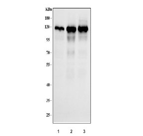 Western blot testing of human 1) HeLa, 2) MCF7 and 3) HepG2 cell lysate with TRIM24 antibody. Expected molecular weight: 117-140 kDa.