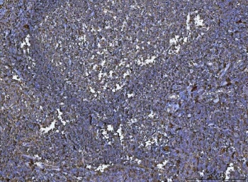 IHC staining of FFPE human tonsil tissue with HLA-DRA antibody. HIER: boil tissue sections in pH8 EDTA for 20 min and allow to cool before testing.