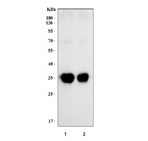 Western blot testing of human 1) Raji and 2) Daudi cell lysate with HLA-DRA antibody. Expected molecular weight ~35 kDa.
