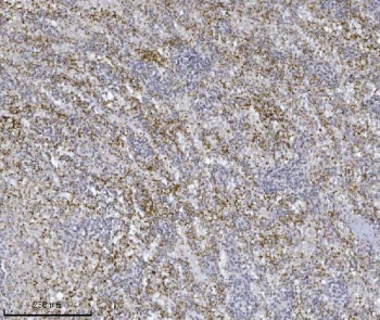 IHC staining of FFPE human spleen tissue with Integrin linked ILK antibody. HIER: boil tissue sections in pH8 EDTA for 20 min and allow to cool before testing.