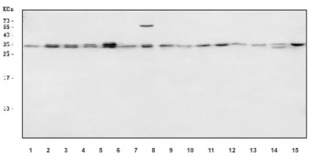 Western blot testing of 1) human placenta, 2) human PC-3, 3) human HeLa, 4) human HepG2, 5) human 293T, 6) human A431, 7) human A549, 8) rat brain, 9) rat liver, 10) rat PC-12, 11) rat NRK, 12) mouse brain, 13) mouse liver, 14) mouse Neuro-2a and 15) mouse RAW264.7 cell lysate with ALYREF antibody. Predicted molecular weight ~27 kDa.
