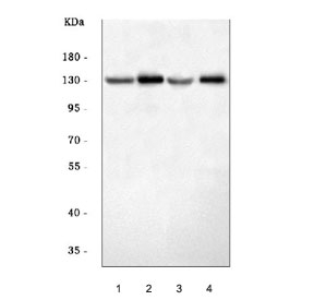 Western blot testing of 1) rat testis, 2) rat stomach, 3) mouse testis and 4) mouse stomach tissue lysate with ATP4A antibody. Predicted molecular weight ~114 kDa.
