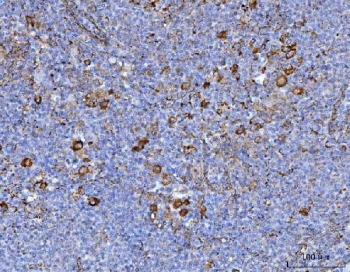 IHC staining of FFPE human spleen tissue with AXIN2 antibody. HIER: boil tissue sections in pH8 EDTA for 20 min and allow to cool before testing.