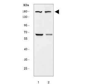 Western blot testing of 1) rat testis and 2) mouse testis tissue with BRDT ant