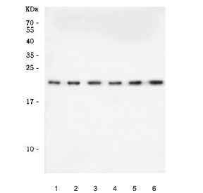 Western blot testing of human 1) 293T, 2) MOLT-4, 3) HepG2, 4) PC-3, 5) Daudi and 6) T-47D cell lysate with CCDC115 antibody. Predicted molecular weight ~20 kDa.