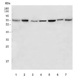 Western blot testing of human 1) 293T, 2) Caco-2, 3) MOLT4, 4) Raji, 5) HeLa, 6) HaCaT and 7) SiHa cell lysate with M-phase inducer phosphatase 2 antibody. Expected molecular weight: 61~67 kDa (isoforms 1-4).