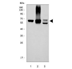Western blot testing of 1) human HepG2, 2) human HCCP and 3) mouse liver tissue lysate with CES2 antibody. Predicted molecular weight ~62 kDa.
