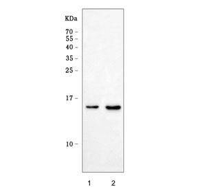 Western blot testing of human 1) MCF-7 and 2) T-47D cell lysate with CRABP2 antibody. Predicted molecular weight ~16 kDa.
