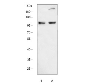 Western blot testing of human 1) RT4 and 2) MCF7 cell lysate with DNM2 antibod