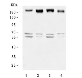 Western blot testing of human 1) HeLa, 2) MCF7, 3) RT4 and 4) HaCaT cell lysate with ERBB2 antibody. Expected molecular weight: 139-185 kDa depending on glycosylation level.