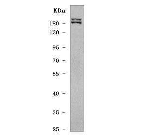 Western blot testing of human HeLa cell lysate with GOLGA3 antibody. Predicted molecular weight 160~170 kDa.