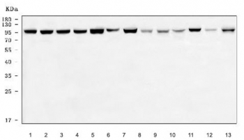 Western blot testing of 1) human HeLa, 2) human HepG2, 3) human RT4, 4)