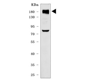 Western blot testing of human HeLa cell lysate with IRS2 antibody. Predicted molecular weight ~137 kDa but it may be observed at up to ~190 kDa due to phosphorylation.