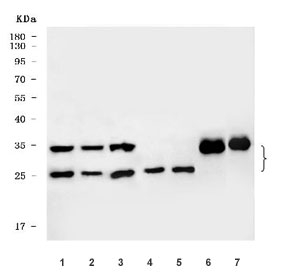 Western blot testing of 1) human HeLa, 2) human HepG2, 3) human SiHa, 4) human MOLT-4, 5) human HEL, 6) rat brain and 7) mouse brain tissue lysate with Mitochondrial fission factor antibody. Predicted molecular weight: 25-38 kDa (multiple isoforms).